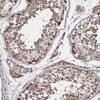 Immunohistochemistry-Paraffin: SMYD3 Antibody [NBP2-58364]