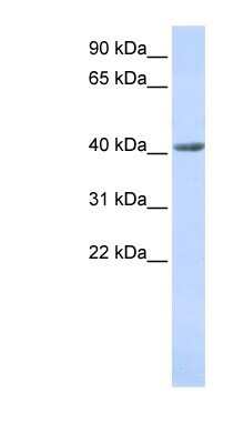 Western Blot: SMYD3 Antibody [NBP1-79393]