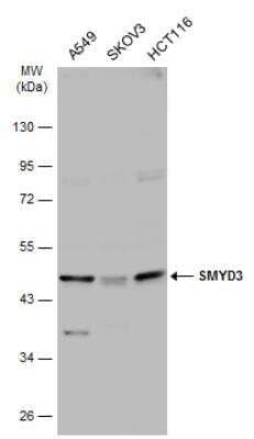 Western Blot: SMYD3 Antibody [NBP2-20430]