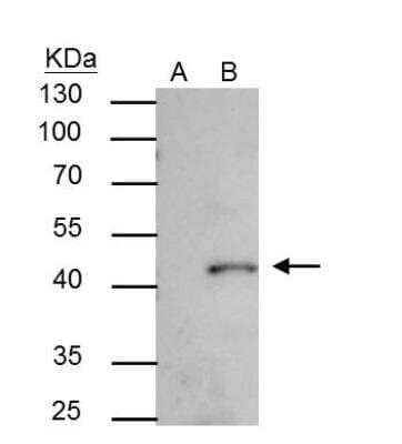 Western Blot: SMYD3 Antibody [NBP2-20432]