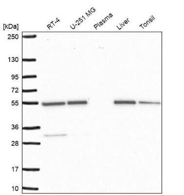 Western Blot: SMYD3 Antibody [NBP2-55477]