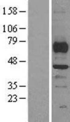 Western Blot: SMYD3 Overexpression Lysate [NBL1-16262]