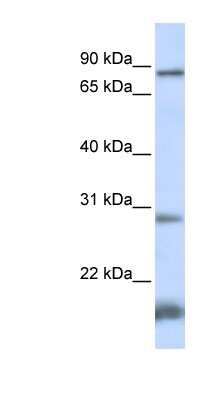 Western Blot: SMYD4 Antibody [NBP1-79406]