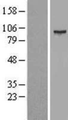 Western Blot: SMYD4 Overexpression Lysate [NBL1-16263]