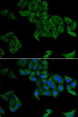 Immunocytochemistry/ Immunofluorescence: SMYD5 Antibody - BSA Free [NBP2-94399]