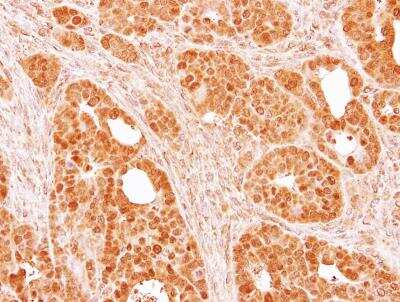 Immunohistochemistry-Paraffin: SMYD5 Antibody [NBP1-31222]