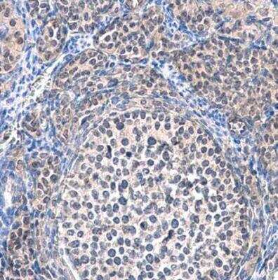 Immunohistochemistry-Paraffin: SMYD5 Antibody [NBP1-31222]