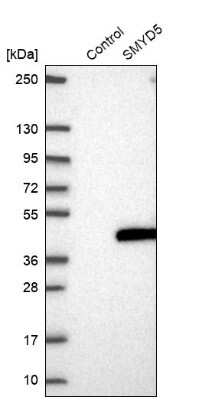 Western Blot: SMYD5 Antibody [NBP2-38598]