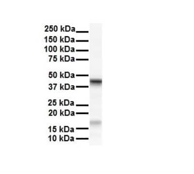 Western Blot: SMYD5 Antibody [NBP2-88318]