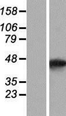 Western Blot: SMYD5 Overexpression Lysate [NBP2-07674]