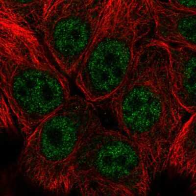 Immunocytochemistry/ Immunofluorescence: SNAI3 Antibody [NBP2-58845]