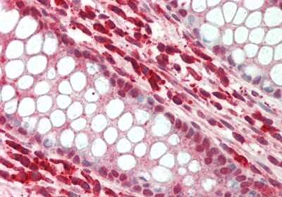 Immunohistochemistry-Paraffin: SNAI3 Antibody [NBP2-85784]