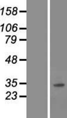 Western Blot: SNAI3 Overexpression Lysate [NBP2-04982]