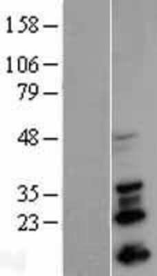 Western Blot: Snail Overexpression Lysate [NBL1-16265]