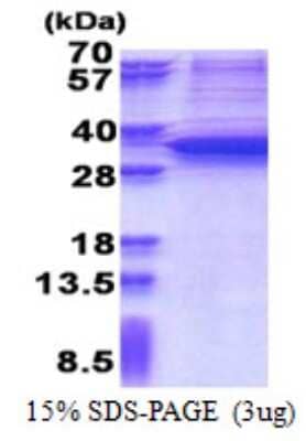 SDS-PAGE: Recombinant Human Snail His Protein [NBP2-22814]