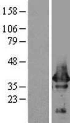 Western Blot: NAPA Overexpression Lysate [NBL1-13474]