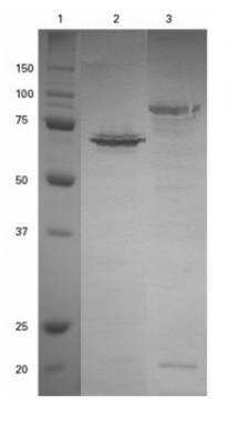 Western Blot: SNAP tag Antibody [NBP2-37817]