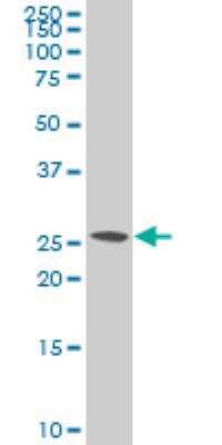 Western Blot: SNAP23 Antibody (2F5-3D4) [H00008773-M01]