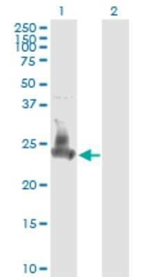 Western Blot: SNAP23 Antibody (2F5-3D4) [H00008773-M01]