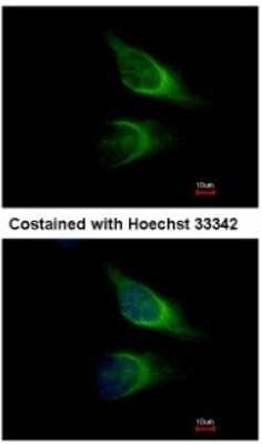 Immunocytochemistry/ Immunofluorescence: SNAP23 Antibody [NBP1-32694]