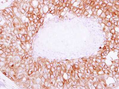Immunohistochemistry-Paraffin: SNAP23 Antibody [NBP2-20434]