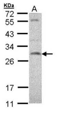Western Blot: SNAP23 Antibody [NBP1-32694]