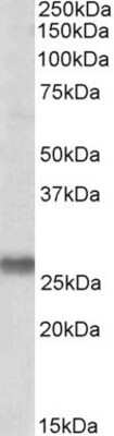 Western Blot: SNAP23 Antibody [NBP1-49855]