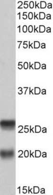 Western Blot: SNAP23 Antibody [NBP1-52065]