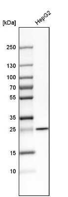 Western Blot: SNAP23 Antibody [NBP1-83162]