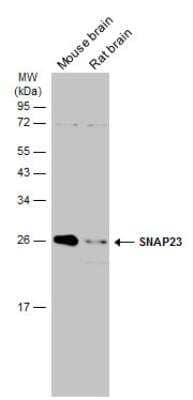 Western Blot: SNAP23 Antibody [NBP2-20434]