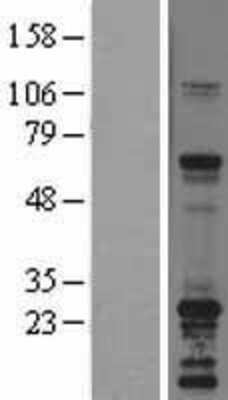 Western Blot: SNAP23 Overexpression Lysate [NBL1-16267]