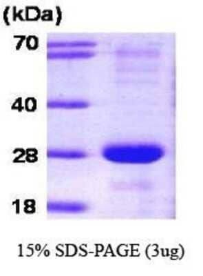 SDS-PAGE: Recombinant Human SNAP23 Protein [NBC1-18347]