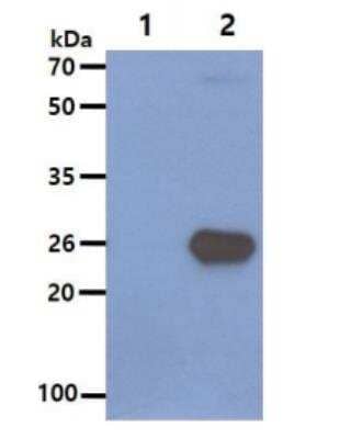 Western Blot: SNAP25 Antibody (4E11)BSA Free [NBP1-04344]