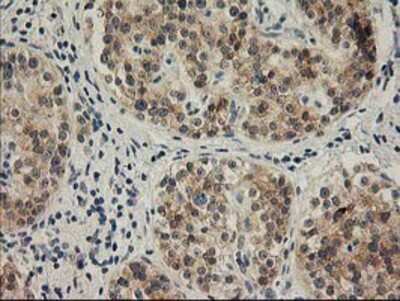 Immunohistochemistry-Paraffin: SNAP25 Antibody (OTI4G5) [NBP2-00795]