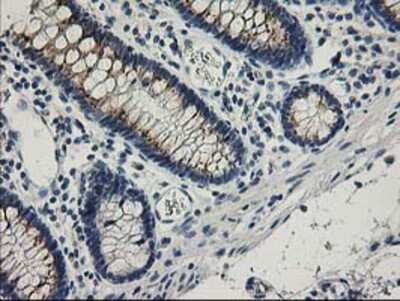 Immunohistochemistry-Paraffin: SNAP25 Antibody (OTI4G5) [NBP2-00795]