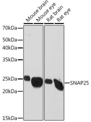 Western Blot: SNAP25 Antibody (7Y9E3) [NBP3-16099]