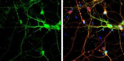 Immunocytochemistry/ Immunofluorescence: SNAP25 Antibody [NBP1-33714]