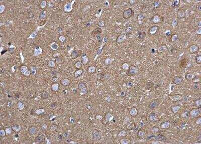 Immunohistochemistry-Paraffin: SNAP25 Antibody [NBP1-33714]