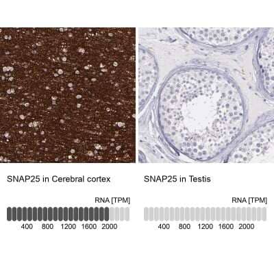 Immunohistochemistry-Paraffin: SNAP25 Antibody [NBP1-88769]