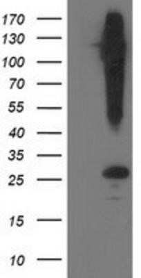 Western Blot: SNAP25 Antibody (OTI4G5)Azide and BSA Free [NBP2-74245]