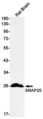 Western Blot: SNAP25 Antibody (S01-1C6) [NBP3-19776]