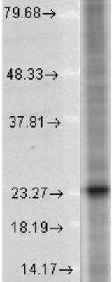 Western Blot: SNAP25 Antibody (SP12)BSA Free [NB600-692]