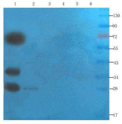 Western Blot: SNAP25 Antibody (SP12)ChimericAzide and BSA Free [NBP2-81057]