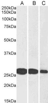 Western Blot: SNAP25 Antibody [NB100-1492]