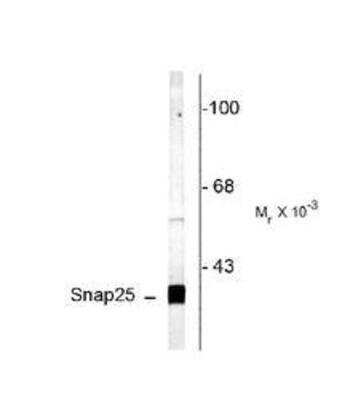 Western Blot: SNAP25 Antibody [NB300-737]