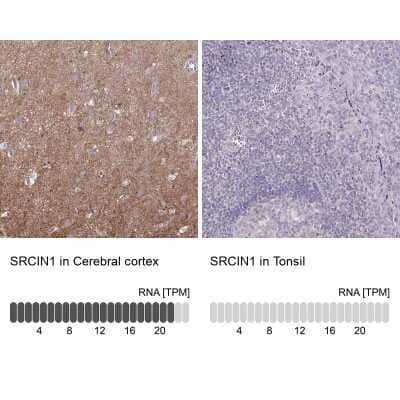 Immunohistochemistry-Paraffin: SNAP25 Interacting Protein Antibody [NBP2-39005]