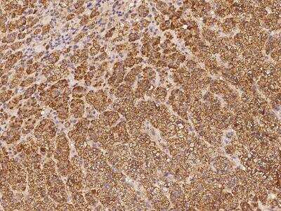 Immunohistochemistry-Paraffin: SNAP25 Interacting Protein Antibody [NBP3-06261]