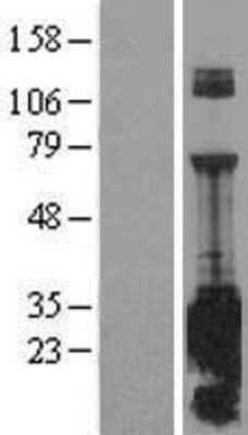 Western Blot: SNAP25 Overexpression Lysate [NBL1-16268]