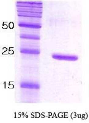 SDS-PAGE: Recombinant C. elegans SNAP25 Protein [NBC1-18330]