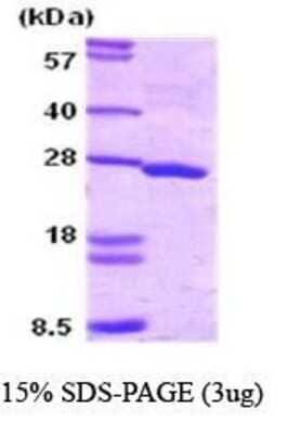 SDS-PAGE: Recombinant Human SNAP25 Protein [NBC1-18344]